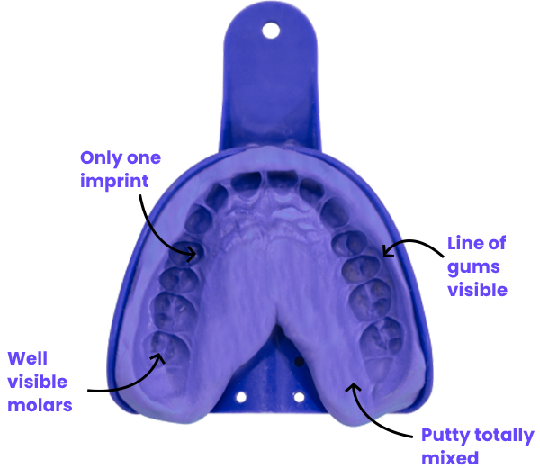 How to Take Dental Impressions at Home – Smilekaro